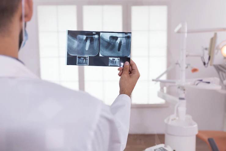 radiografía periapical