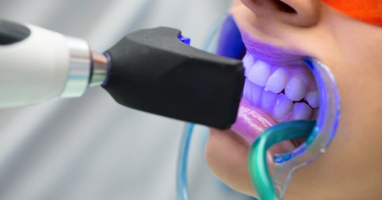 que es blanqueamiento dental 1200x630.original